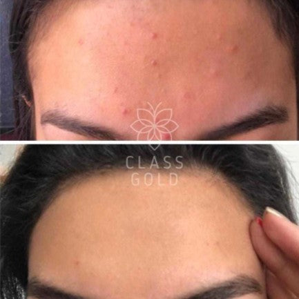 Jabón Facial Antioxidante Piel Seca 32gr Rosa