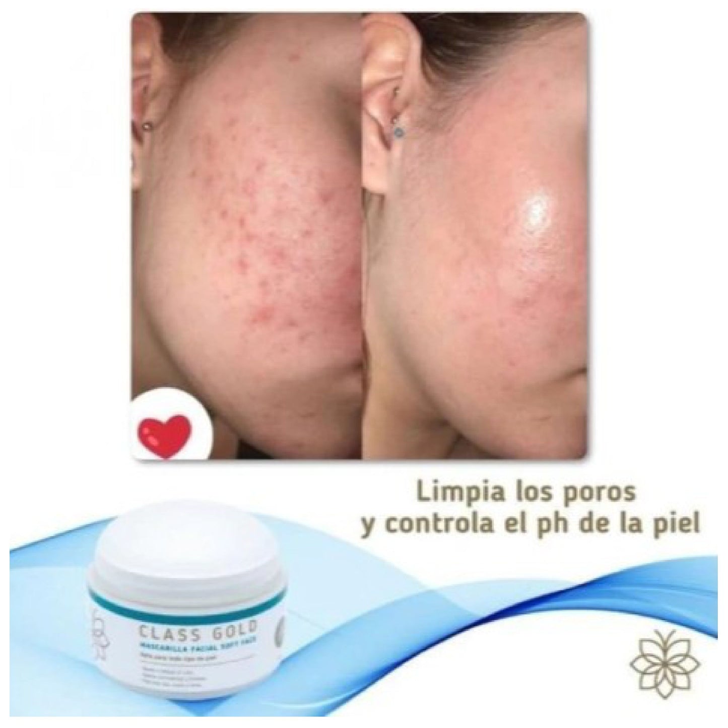 Mascarilla Soft Face Class Gold