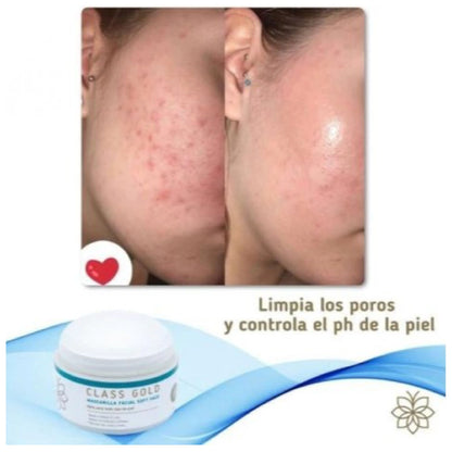 Mascarilla Soft Face Class Gold